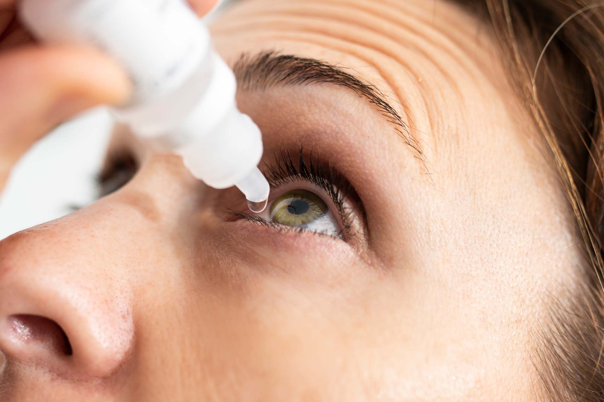 woman applying eye drops to her eyes for conjunctivitis or dry eyes. eye doctor prescription